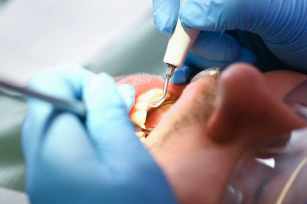 Best Emergency Dentist for Knocked-Out Tooth in Fern Acres, HI